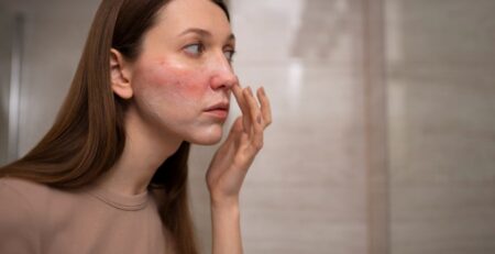 gül suyu gözenekleri küçültür mü